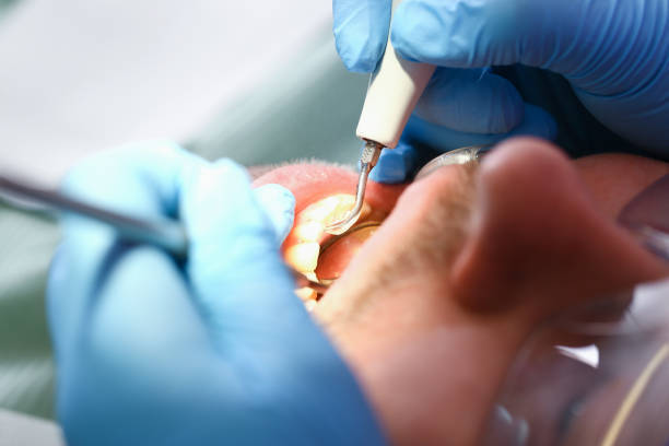 Best Mobile Emergency Dentist in Rson, CA