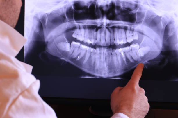 Best Holiday Emergency Dentist in Rson, CA