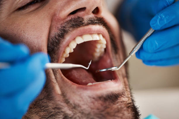 Best Orthodontic Emergency Dentist in Rson, CA
