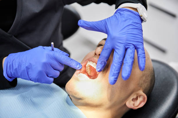 Best Emergency Dental Care for Abscessed Tooth in Rson, CA