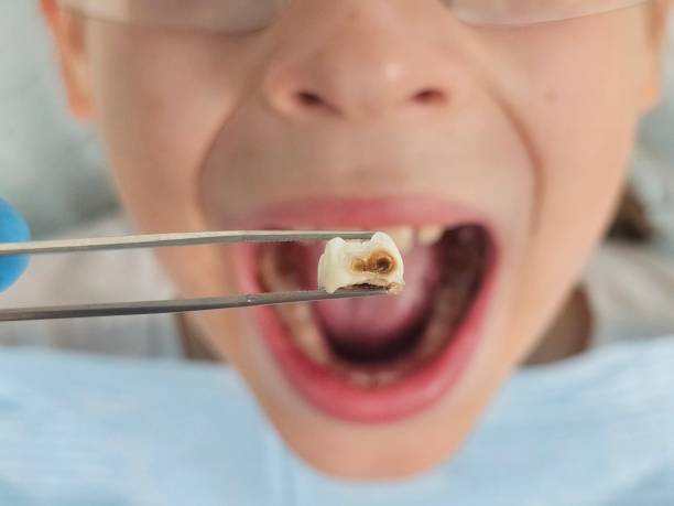 Best Pediatric Emergency Dentist in Rson, CA